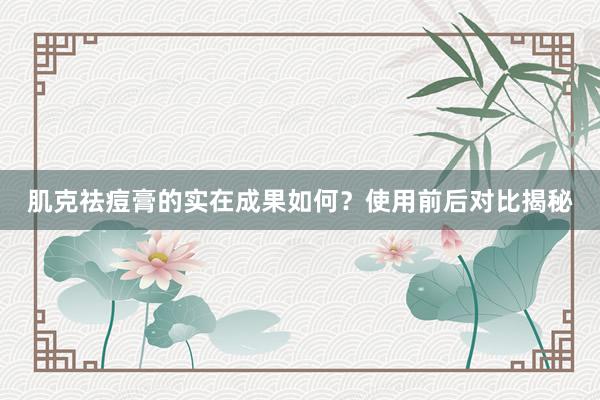 肌克祛痘膏的实在成果如何？使用前后对比揭秘